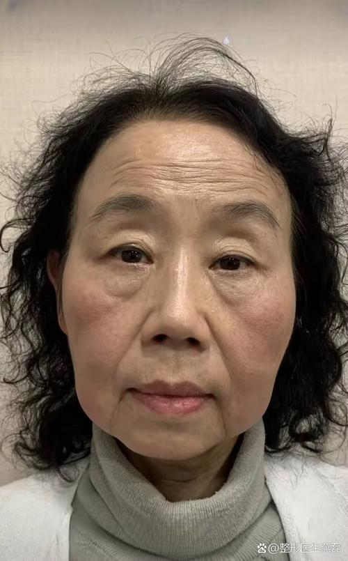 六味地黄治失眠六味地黄丸有治失眠的功效吗 六味地黄治失眠六味地黄丸有治失眠的功效吗