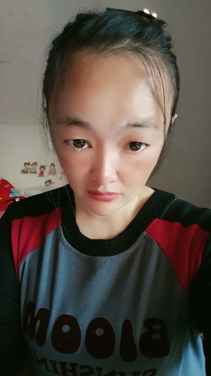 ����ʧ�߿���������ʲô